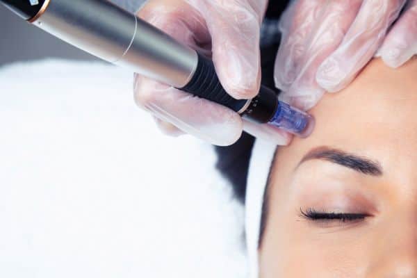 Explaining Total Skin Tightening Treatment and What to Expect 2 What Skin Concerns Can Total Skin Tightening Treatment Help With Thame?